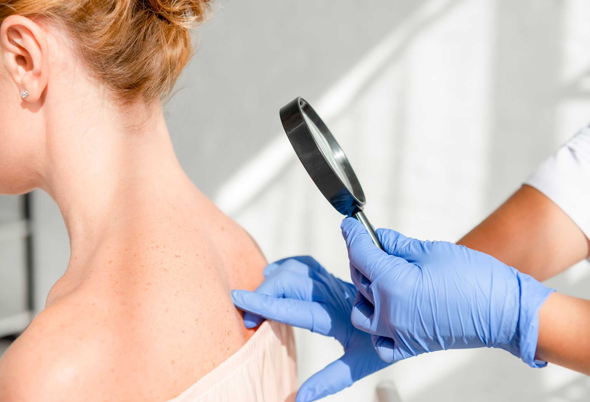 Dermatología y Venereología: enfermedades, síntomas, tratamientos y cuándo acudir al especialista