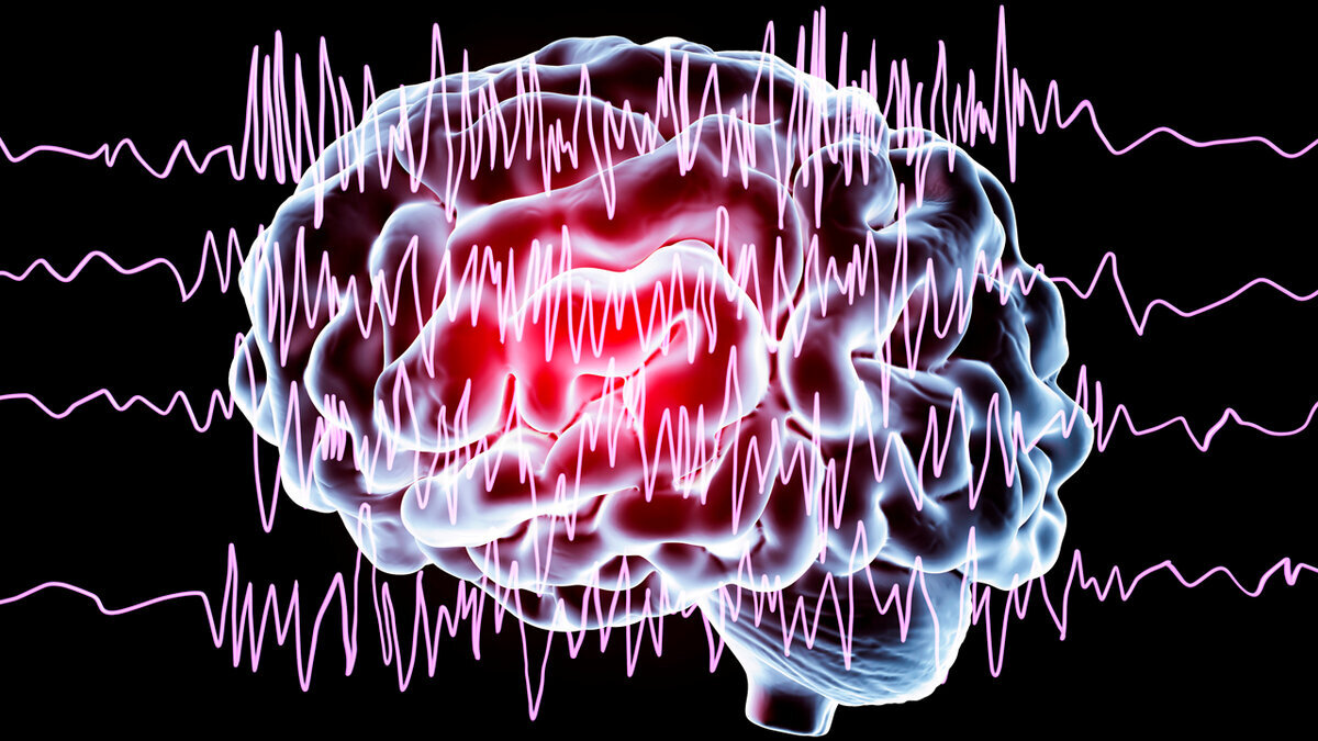 ECA y psicosis: una posible nueva vía para identificar alteraciones en fases tempranas