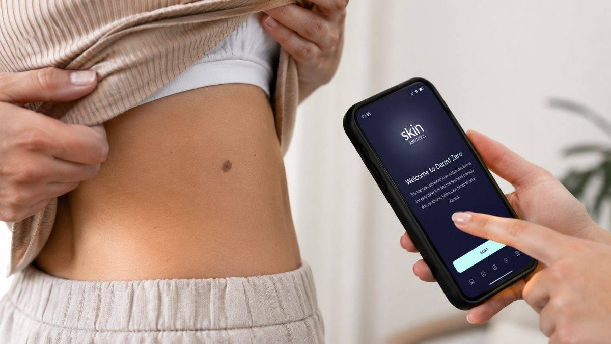 Inteligencia artificial y cáncer de piel: una nueva herramienta permite analizar lesiones desde el móvil