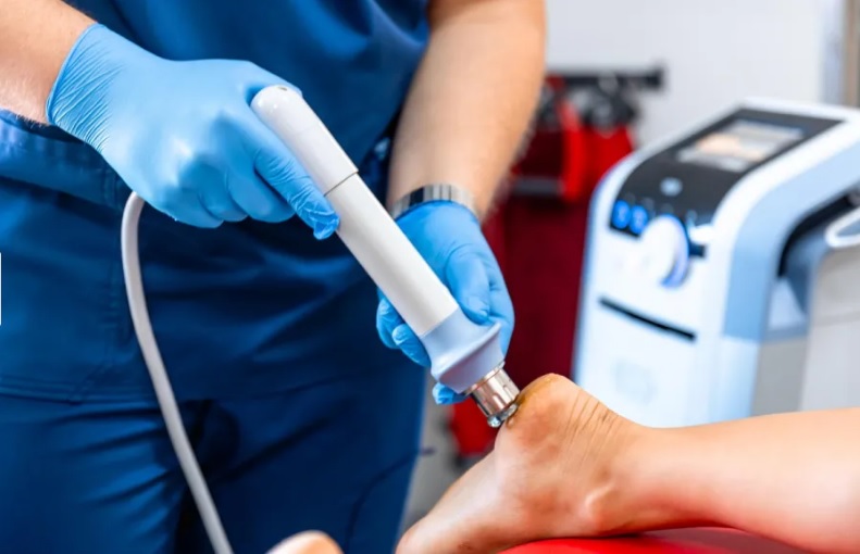 Ondas de choque para la fascitis plantar: ¿es realmente un tratamiento efectivo?