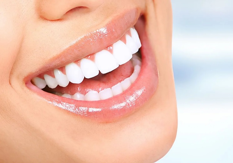 🦷 Seis razones por las que unos dientes bien alineados son mucho más que una cuestión estética