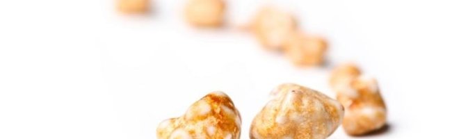 Litiasis renal: qué es, síntomas, diagnóstico, tratamiento y cómo prevenir los cálculos renales