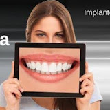 Imbiodent